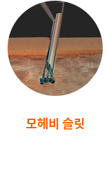 최근 세계의 비절개 방식