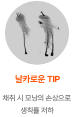 과거의 비절개 방식